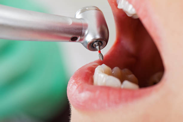 Best Emergency Dental Care for Abscessed Tooth in Central Falls, RI